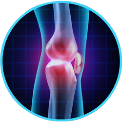 Knee and Joint Pain